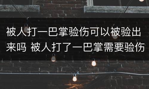 被人打一巴掌验伤可以被验出来吗 被人打了一巴掌需要验伤吗